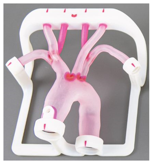EVIAS Plus - Type I Aortic Arch