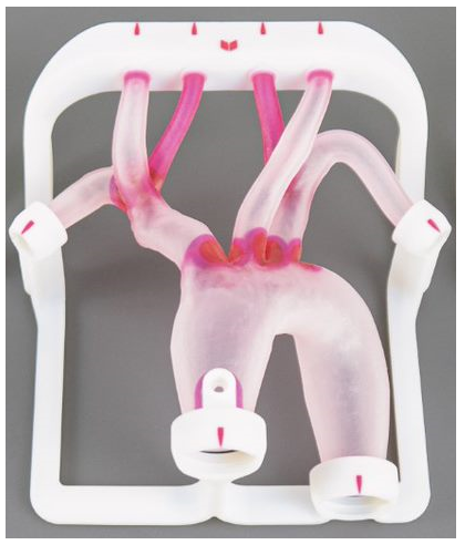EVIAS Plus - Type II Aortic Arch